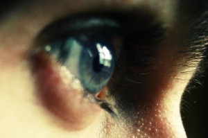 eye 3